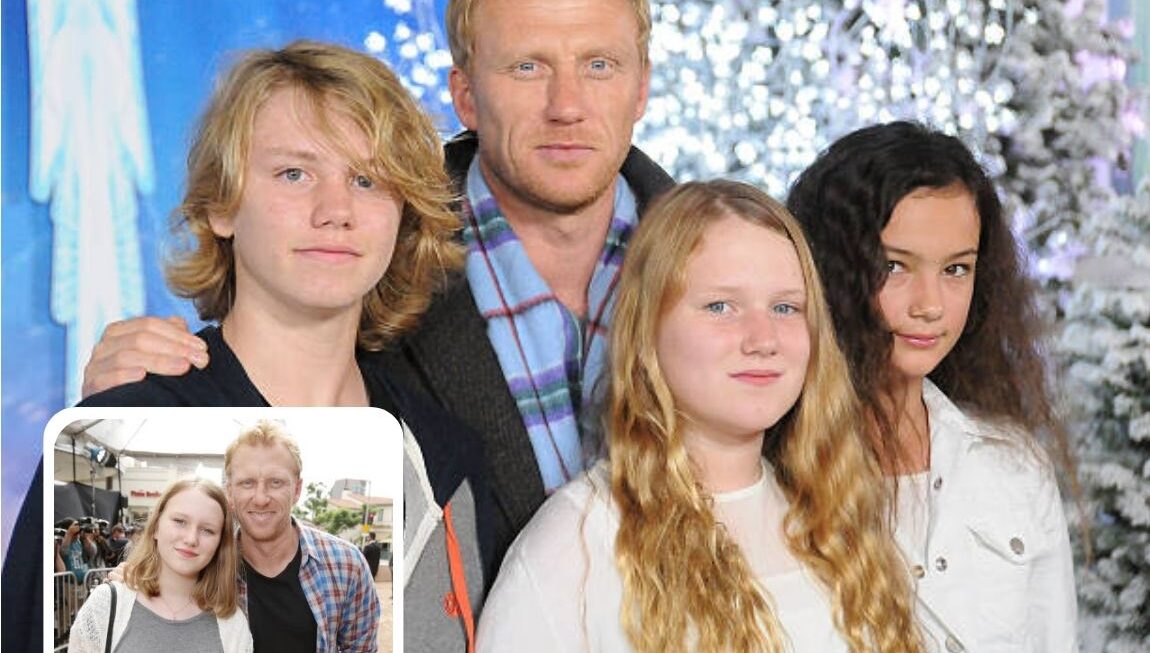 Meet Iona McKidd: Inside the Life of Kevin McKidd’s Daughter